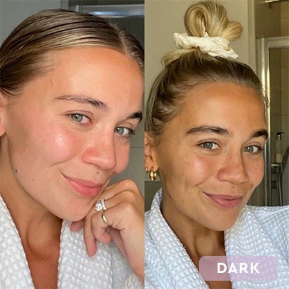 Tanologist Drops Before And After